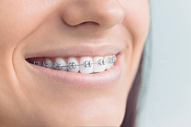 Full Mouth Reconstruction in Victoria, TX